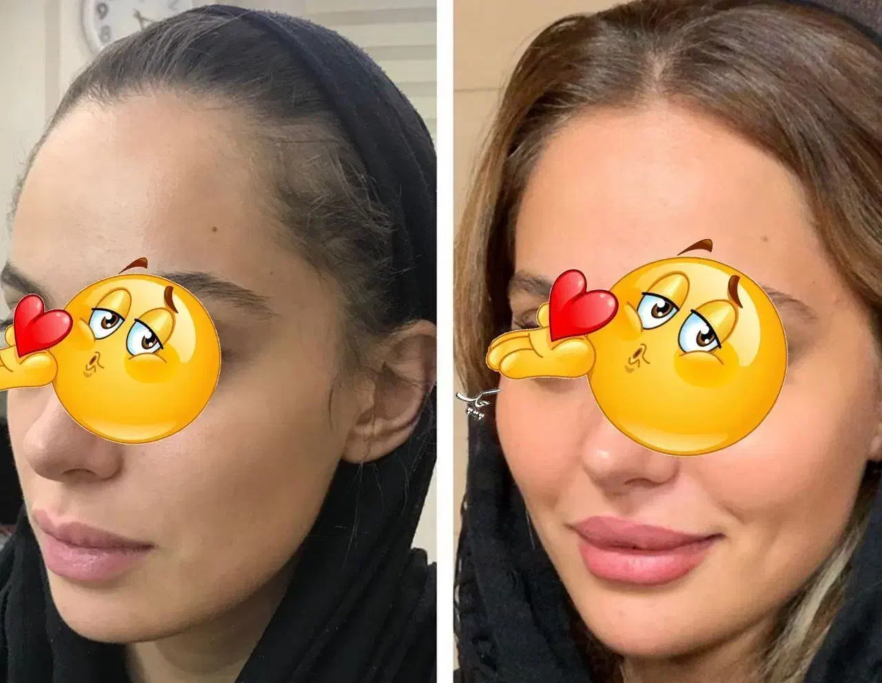 پک چاق کننده صورت و بدن بدون بازگشت و عوارض|آرایشی، بهداشتی، درمانی|ارومیه, |دیوار