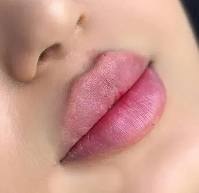 null
