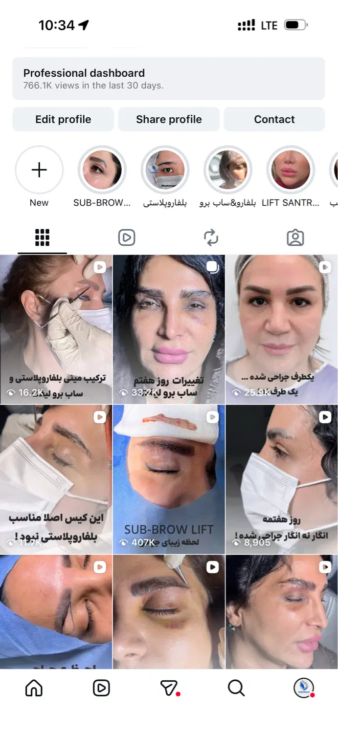 همکاری حرفه‌ای با پزشک جراح زیبایی (پیج فعال دارم)|استخدام درمانی، زیبایی، بهداشتی|تهران, زعفرانیه|دیوار