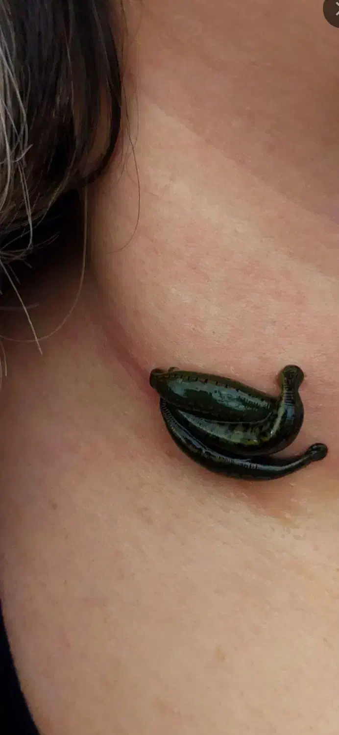 طب سوزنی،حجامت،زالو درمانی،تشخیص بیماری|خدمات آرایشگری و زیبایی|کرج, خرمدشت|دیوار