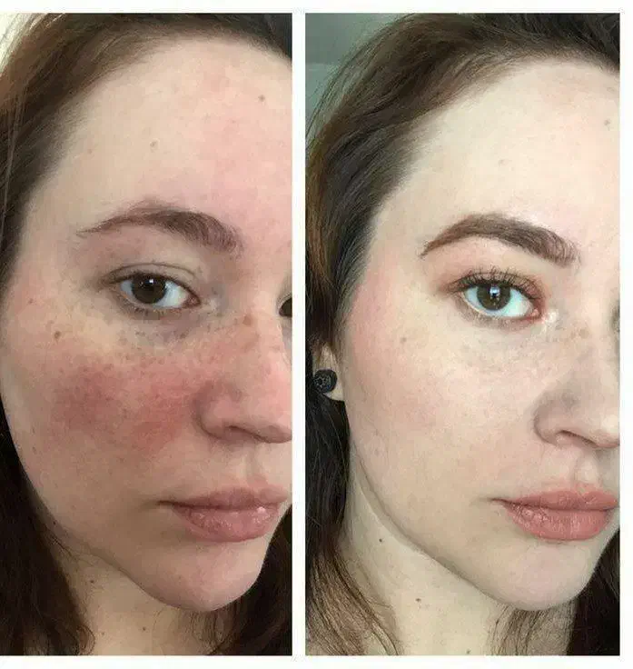 کرم معجزه تضمینی|خدمات آرایشگری و زیبایی|لشت نشا, |دیوار