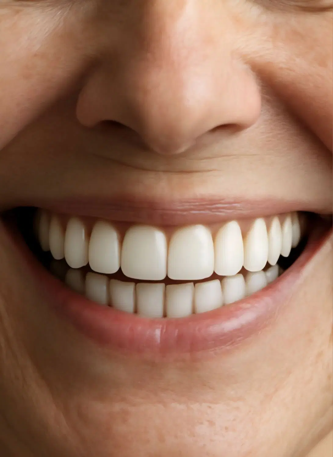 ساخت دندان مصنوعی با بیمه تامین اجتماعی***|خدمات زیبایی و سلامت|تهران, زهتابی|دیوار