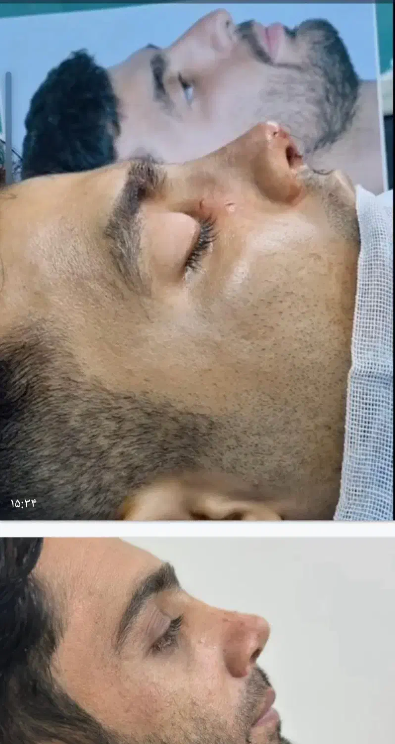 جشنواره جراحی بینی۲۵ تومن .جراحی صورت واندام|خدمات آرایشگری و زیبایی|اسلامشهر, شهرک مهدیه|دیوار