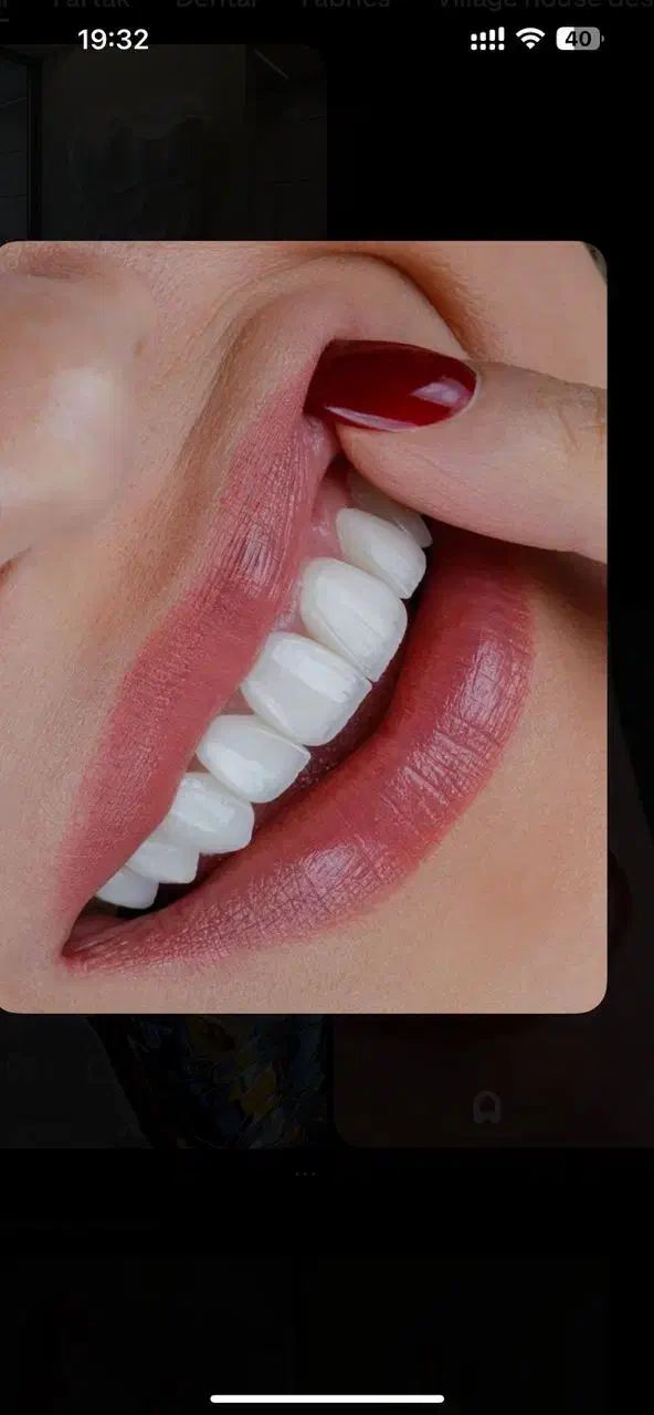 جشنواره بزرگ یلدادستدندانطبیعی+ایمپلنت+کامپوزیت|خدمات آرایشگری و زیبایی|تهران, فلسطین (میدان انقلاب)|دیوار