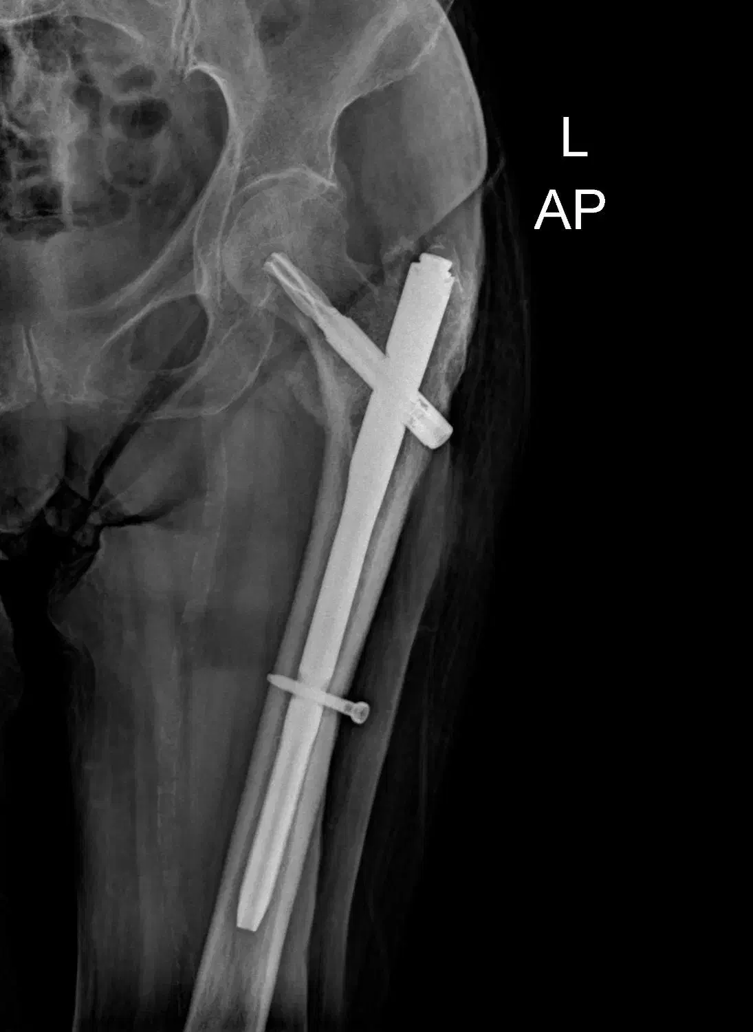 رادیولوژی و سونوگرافی در منزل تهران و کرج|پزشکی|تهران, ونک|دیوار