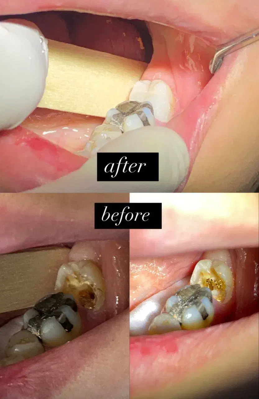 دندانپزشکی بزرگسال و اطفال|خدمات آرایشگری و زیبایی|لاهیجان, شیخ زاهد|دیوار