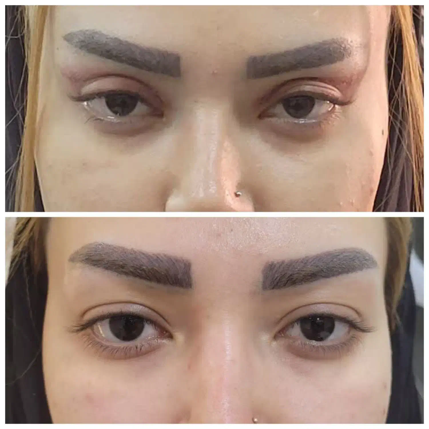 عمل جراحی پلک (بلفاروپلاستی)|خدمات آرایشگری و زیبایی|اصفهان, مسجد مصلی|دیوار