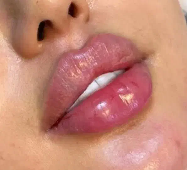 قیمتهای استثنایی کلینیک زیبایی تزریق فیلر ،بوتاکس|خدمات آرایشگری و زیبایی|نسیمشهر, |دیوار