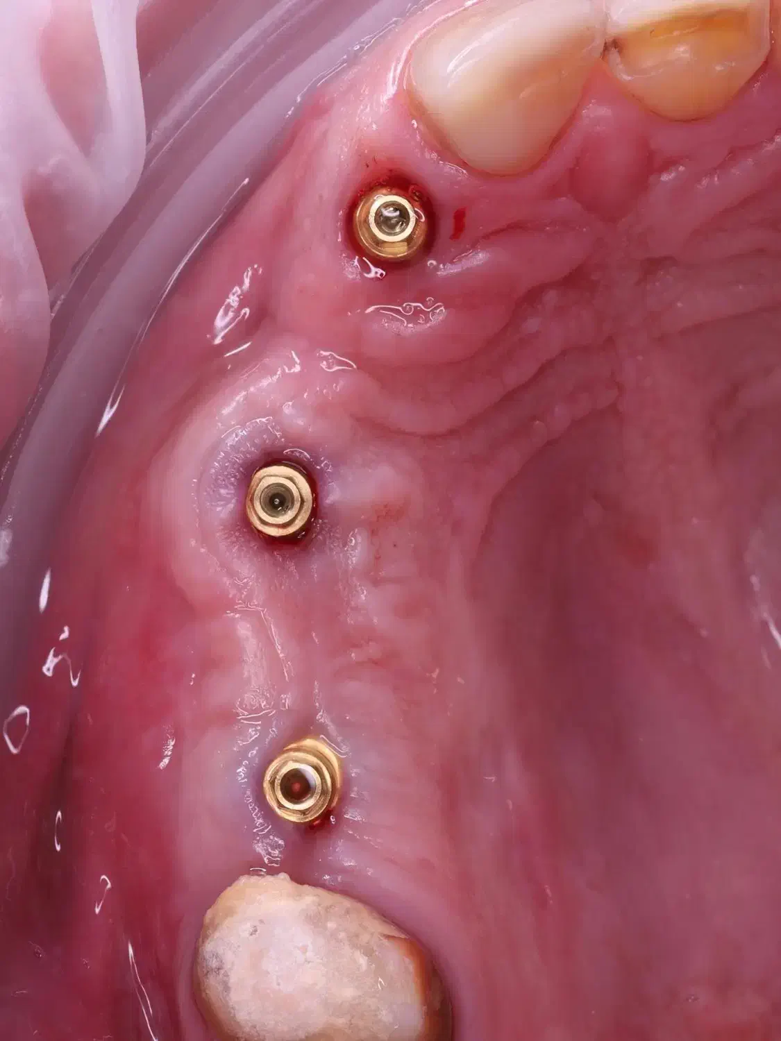 دندانپزشکی ایمپلنت دیجیتال ارتودنسی کامپوزیت لمینت|خدمات آرایشگری و زیبایی|شبستر, |دیوار