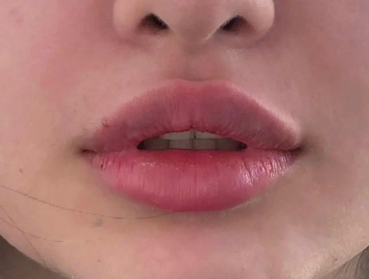 مدل تزریق فیلر لب  استایل نچرال|خدمات آرایشگری و زیبایی|تهران, دروس|دیوار