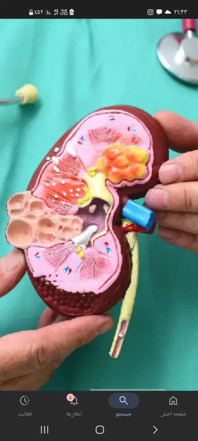 عکس نشان دهنده همهچیز است|پزشکی|زابل, |دیوار