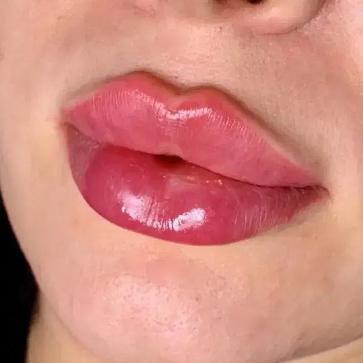 فیلر لب روسی عروسکی|خدمات آرایشگری و زیبایی|سلماس, |دیوار