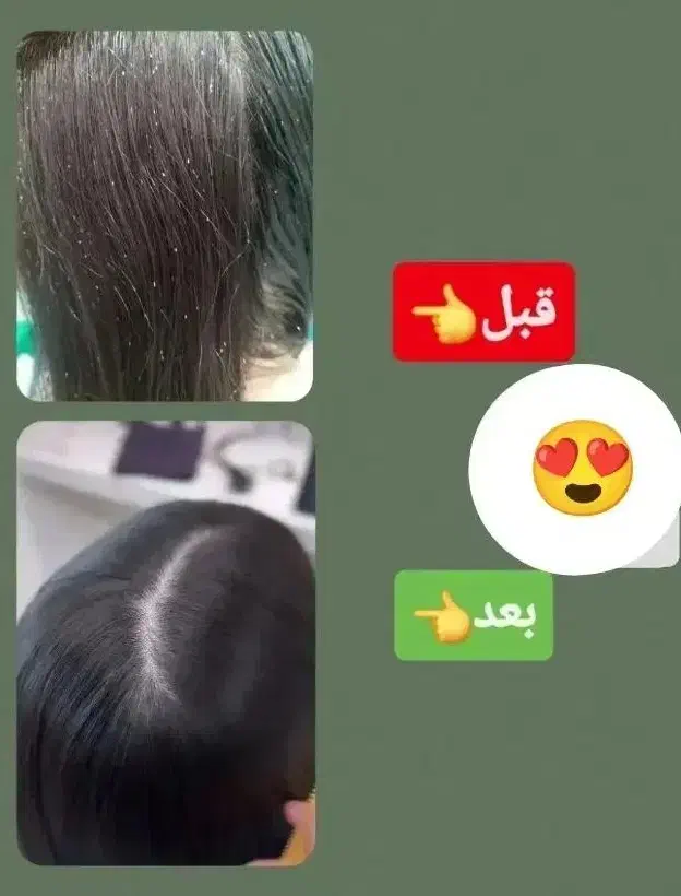 درمان قطعی شپش|آرایشی، بهداشتی، درمانی|پاکدشت, پاکدشت (مامازند)|دیوار