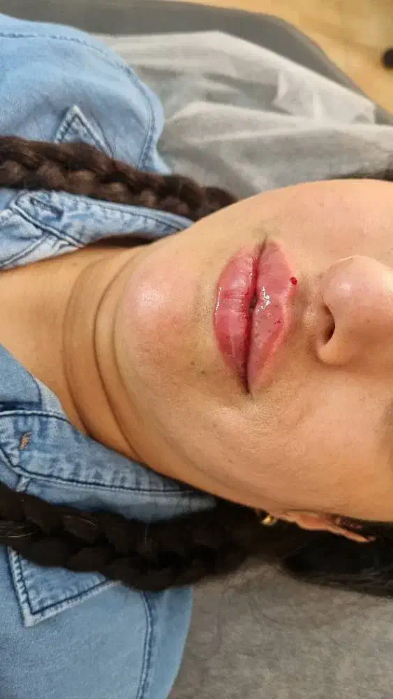 ۵۰٪تخفیف ویژه کلینیک نورا|خدمات آرایشگری و زیبایی|محمدشهر, محمدشهر|دیوار