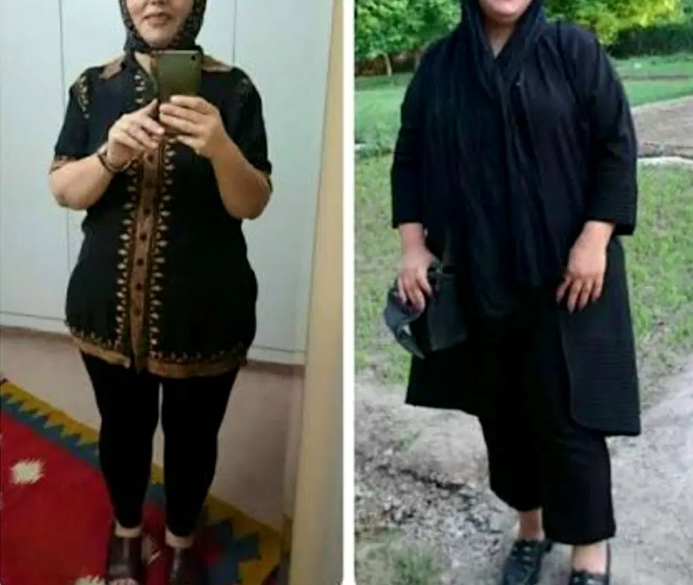 دستگاه لاغری، آمپول لاغری /لاغری بدون جراحی|خدمات زیبایی و سلامت|اهواز, کیانپارس |دیوار