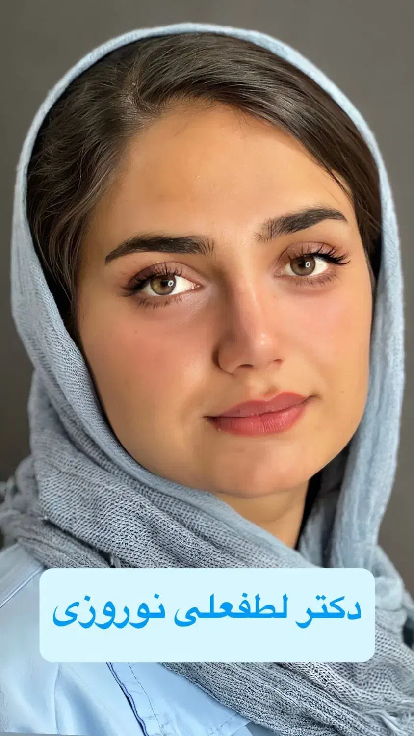 عمل زیبایی بینی با بهترین شرایط|خدمات آرایشگری و زیبایی|داراب, |دیوار