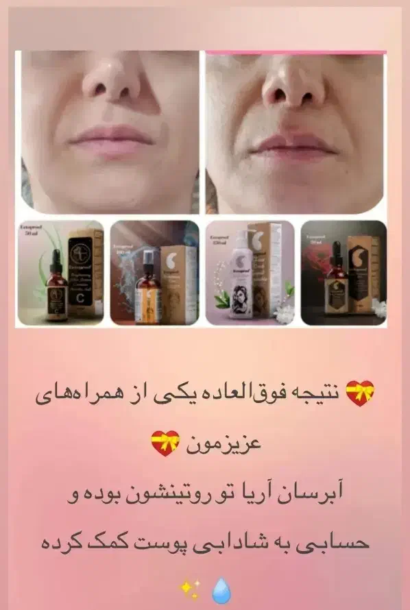 زیبایی از آریا شروع میشه حس رضایتی که از اول|آرایشی، بهداشتی، درمانی|اراک, |دیوار