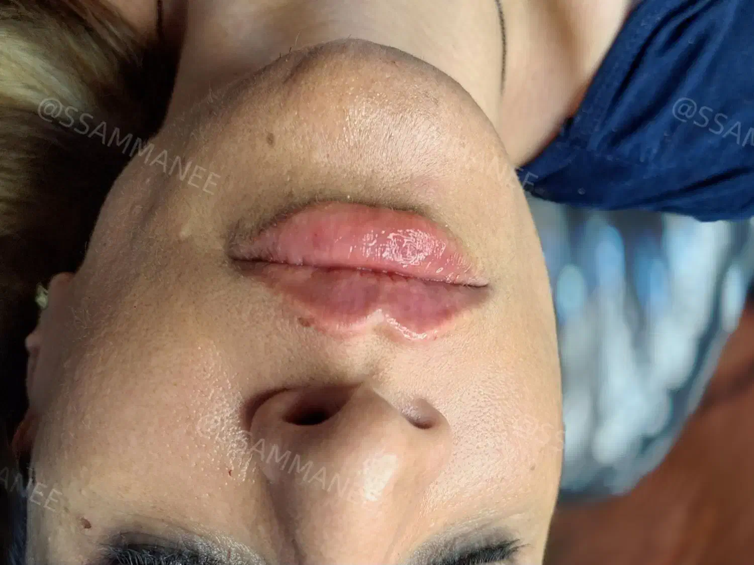 ژل بوتاکس فیلر ،خالبرداری، آموزش فیشیال وپاکسازی|خدمات آرایشگری و زیبایی|شیراز, منطقه هوایی شهید دوران|دیوار