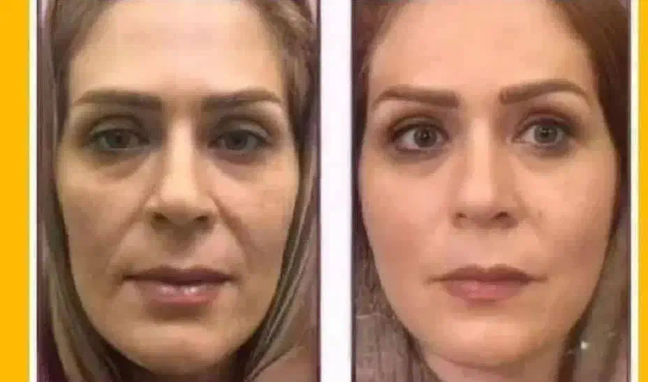 کرم اکسیر جوانی با روغن کاملا طبیعی|آرایشی، بهداشتی، درمانی|دهدشت, |دیوار