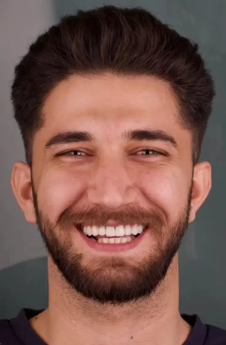 دندانپزشکی اقساطی بدون پیش پرداخت ایمپلنت کامپوزیت|خدمات آرایشگری و زیبایی|خرم‌آباد, |دیوار