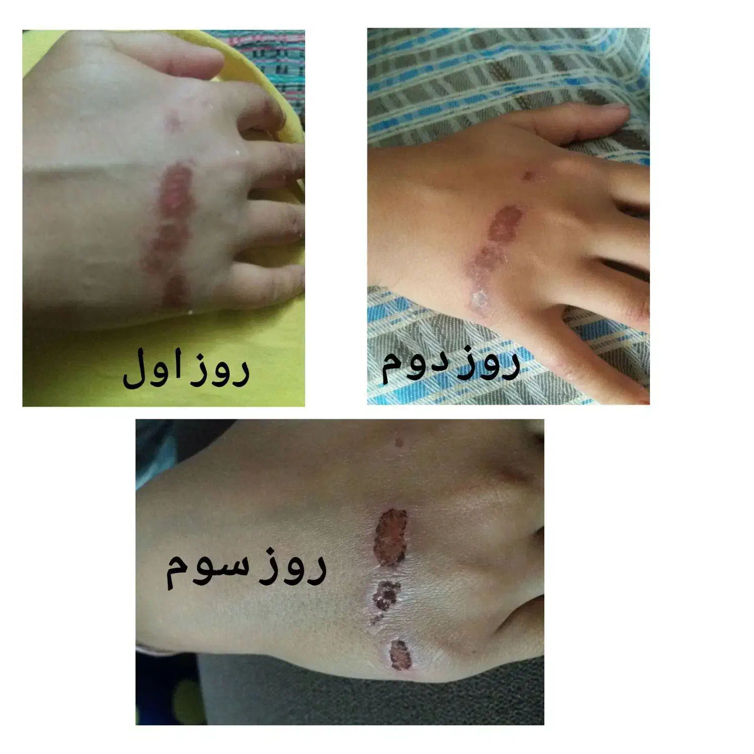 پاسخگوی مشکلات پوستی|فعالیت داوطلبانه|رفسنجان, |دیوار