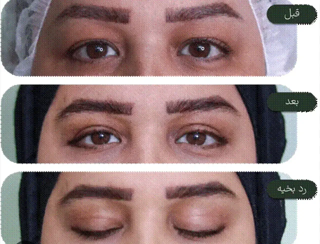 جشنواره پاییزه بلفاروپلاستی|خدمات آرایشگری و زیبایی|تهران, پاسداران|دیوار