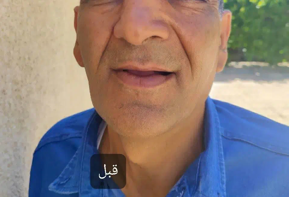 ساخت دندان مصنوعی کامل و تکه ای ضمانتی|آرایشی، بهداشتی، درمانی|مرودشت, بیست متری بیمارستان|دیوار