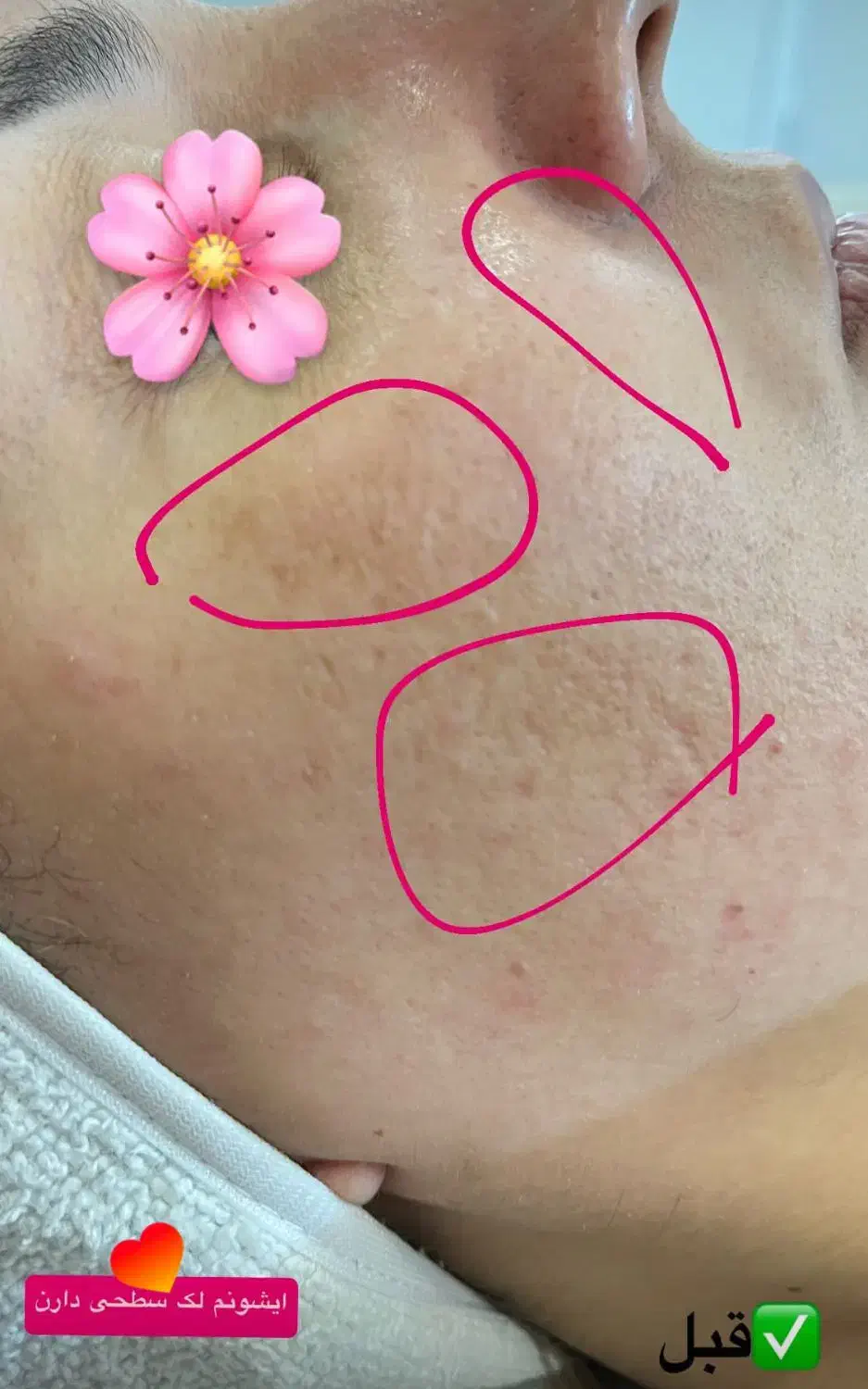 فشیال و اسکراب اسکالپ بطور تخصصی|خدمات آرایشگری و زیبایی|سبزوار, کاشفی شمالی (دادگستری)|دیوار