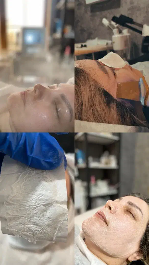 فیشال و جوانسازی پوست|خدمات آرایشگری و زیبایی|قائمشهر, |دیوار