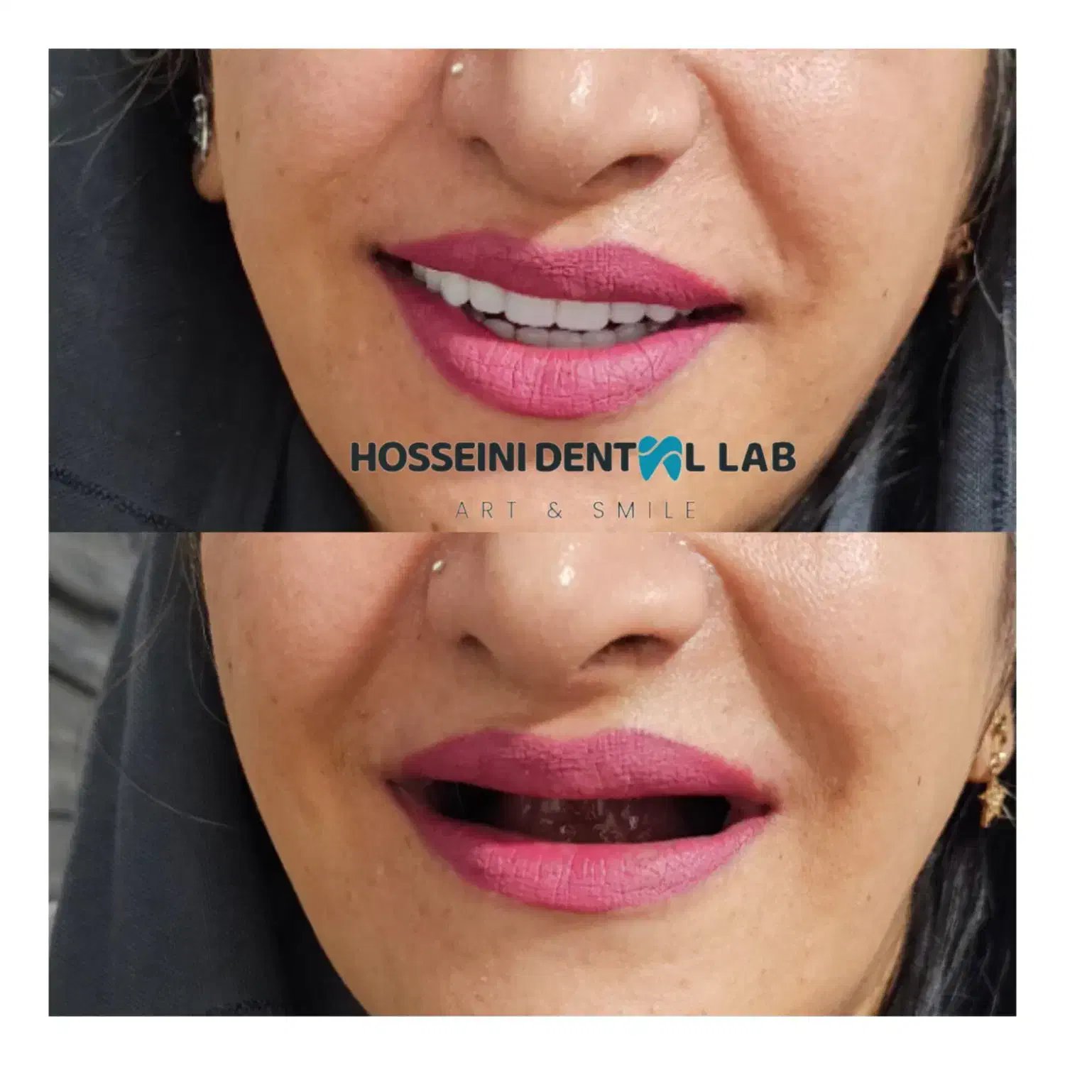 دندانسازی(بلوارهدایت)دندان مصنوعی/دندان سازی|خدمات آرایشگری و زیبایی|مشهد, هدایت|دیوار