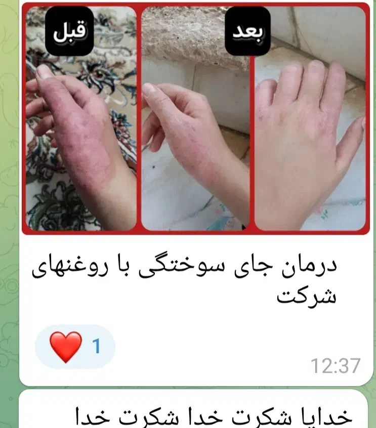 درمانگری باضمانت|خدمات آموزشی|محمدیه-قزوین, |دیوار