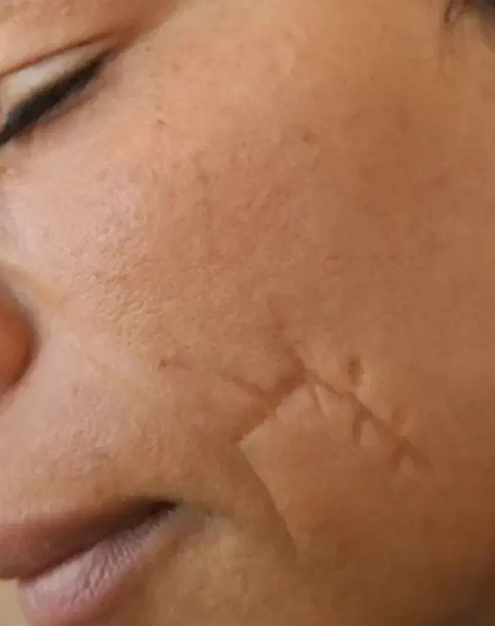 برداشتن لک و کک و مک|خدمات آرایشگری و زیبایی|نورآباد, |دیوار