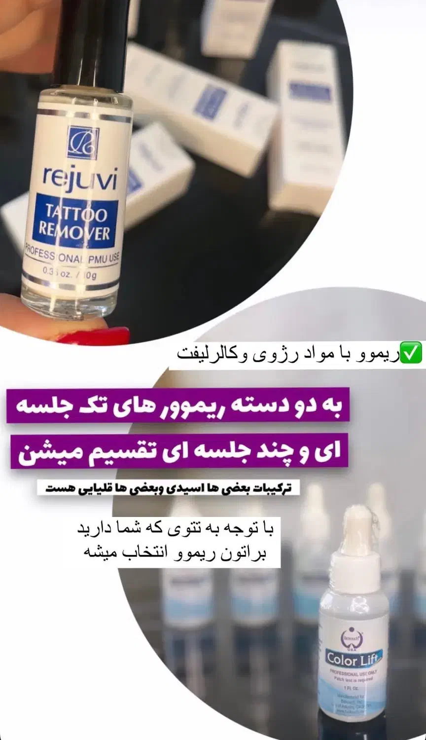 ریموو تتو در یک جلسه با متریال برند|خدمات آرایشگری و زیبایی|بهار, |دیوار