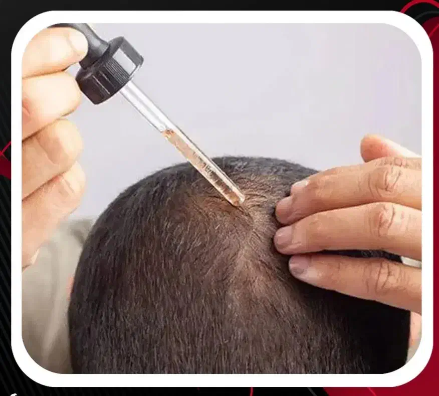 اکسیر گیاهی رویش مو|آرایشی، بهداشتی، درمانی|لاهیجان, کاروانسرابر|دیوار