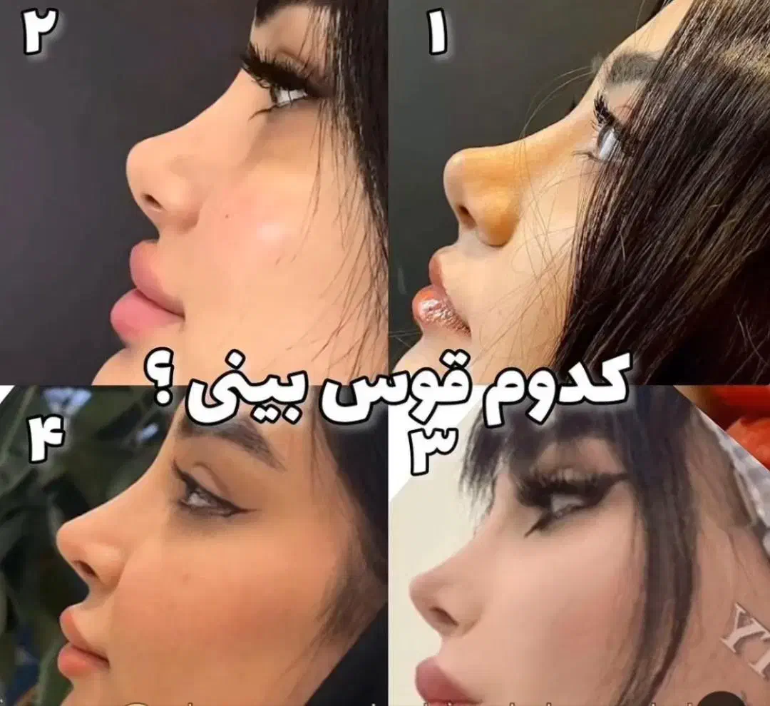 جراحی بینی ماهیانه ۵ میلیون|خدمات آرایشگری و زیبایی|شاهین‌شهر, مخابرات (شهید بهشتی)|دیوار