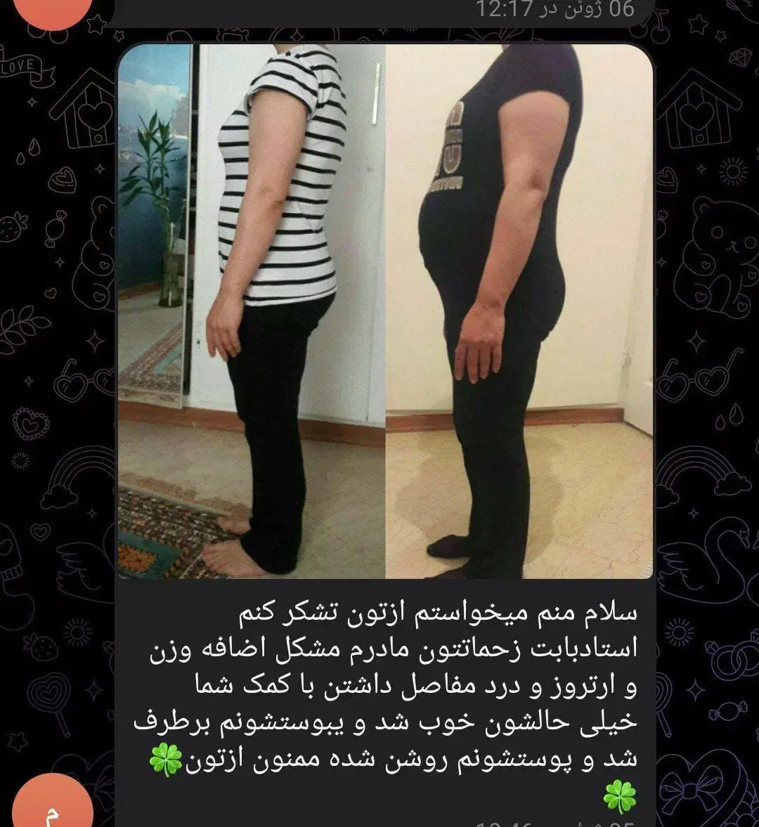 درمان چاقی|آرایشی، بهداشتی، درمانی|کوهدشت, |دیوار