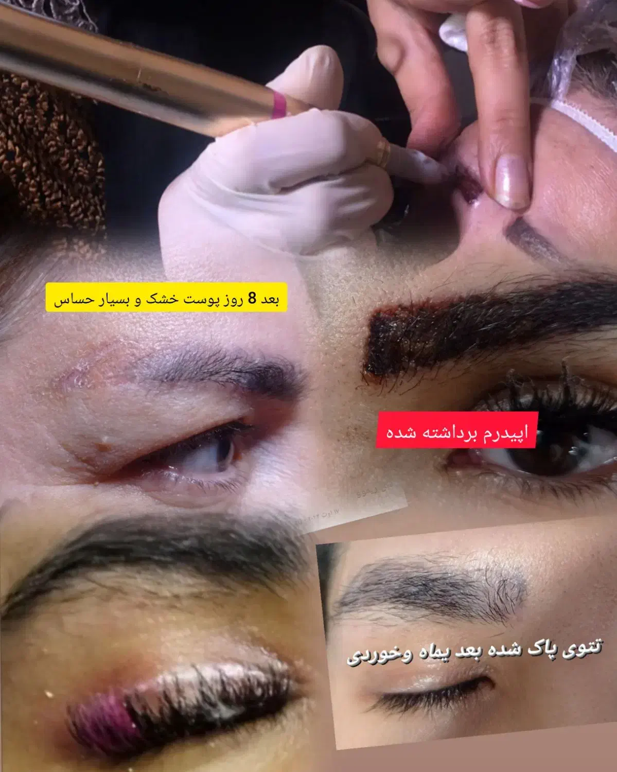 خدمات و آموزش میکرو پیگمنتیشن،میکرو بلیدینگ،ریموو|خدمات آرایشگری و زیبایی|گرگان, |دیوار