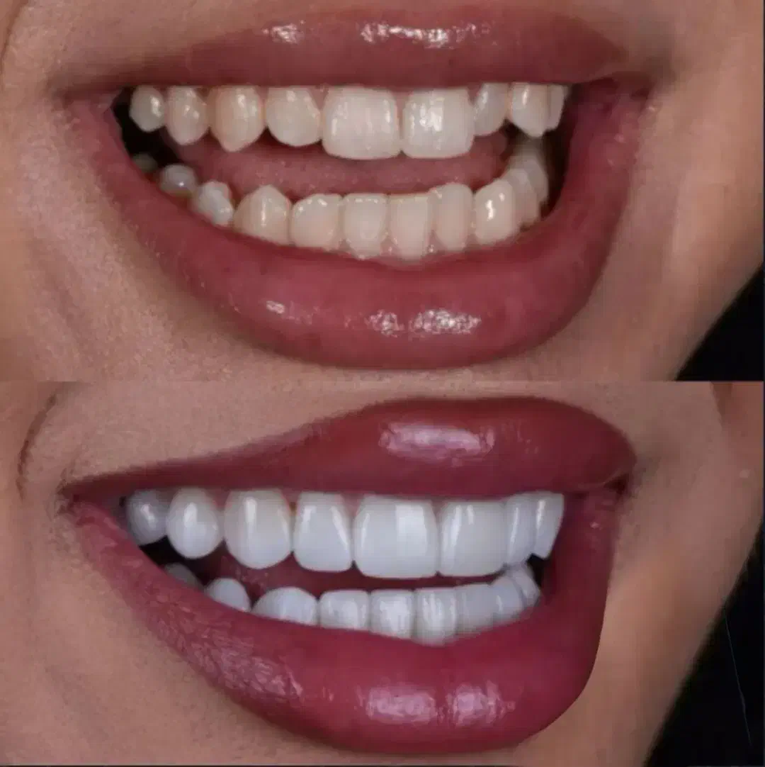خدمات دندانپزشکی با قیمت مناسب|خدمات آرایشگری و زیبایی|تهران, مینابی|دیوار