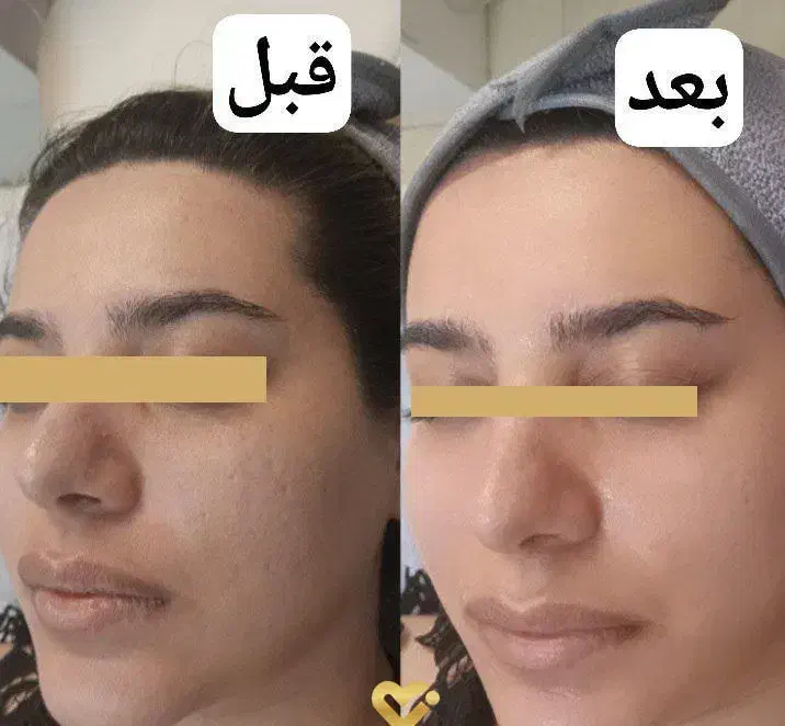 آموزش فیشیال رایگان|خدمات آموزشی|قم, حاج زینل|دیوار