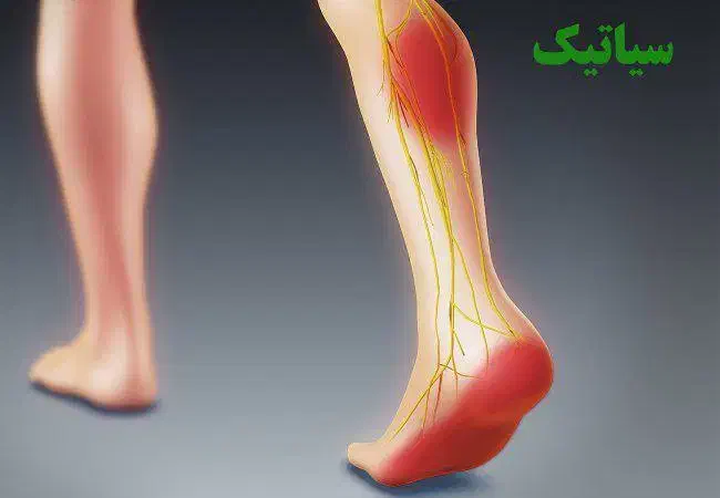 ماساژ درمانی بادکش حجامت تضمینی|خدمات آرایشگری و زیبایی|سنندج, |دیوار