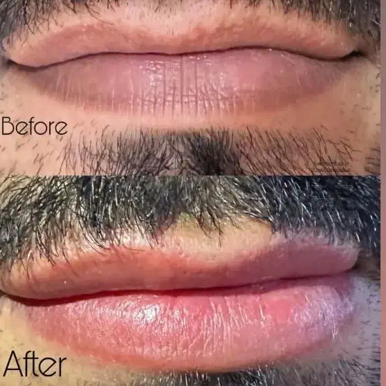 رفع بد رنگی لب کاملا تضمینی با مواد کاملا گیاهی|خدمات آرایشگری و زیبایی|تربتحیدریه, مظفریه|دیوار