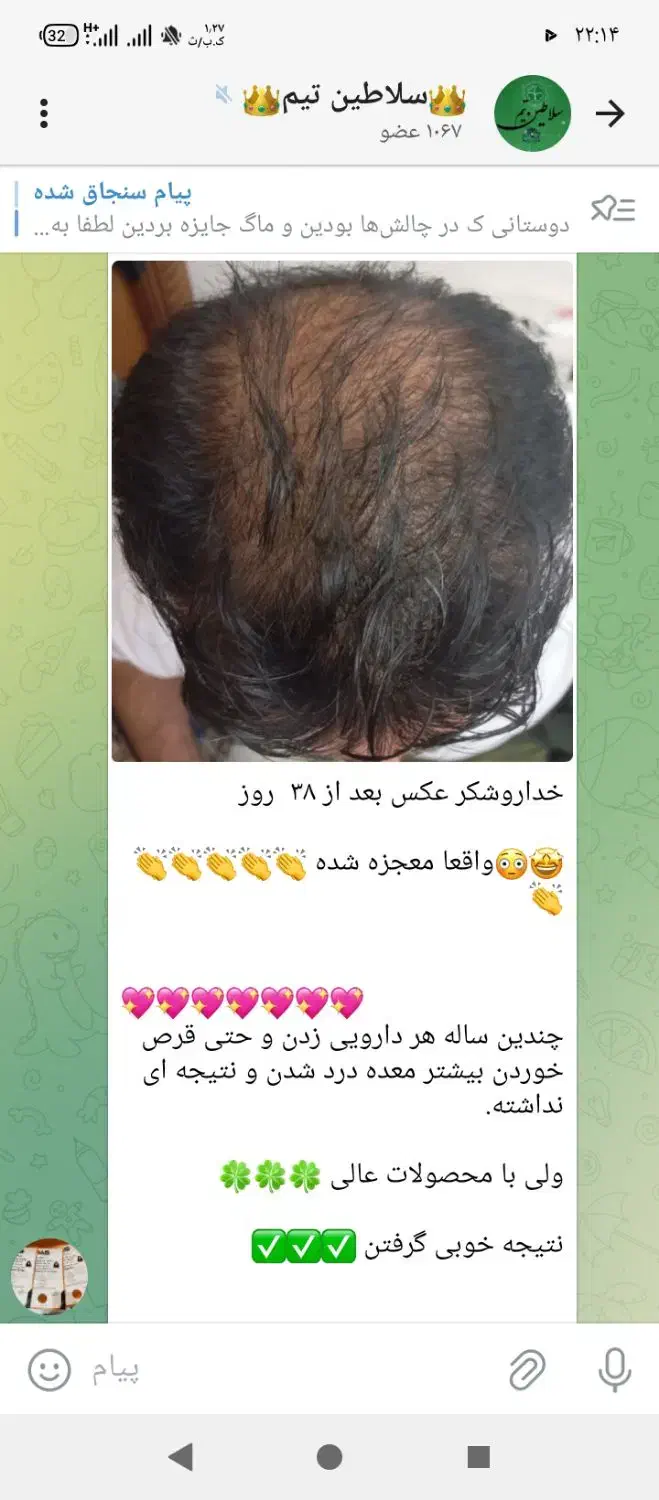 تونیک تقویت کننده مو رشد مجدد|آرایشی، بهداشتی، درمانی|تربتحیدریه, ۴۵ متری|دیوار