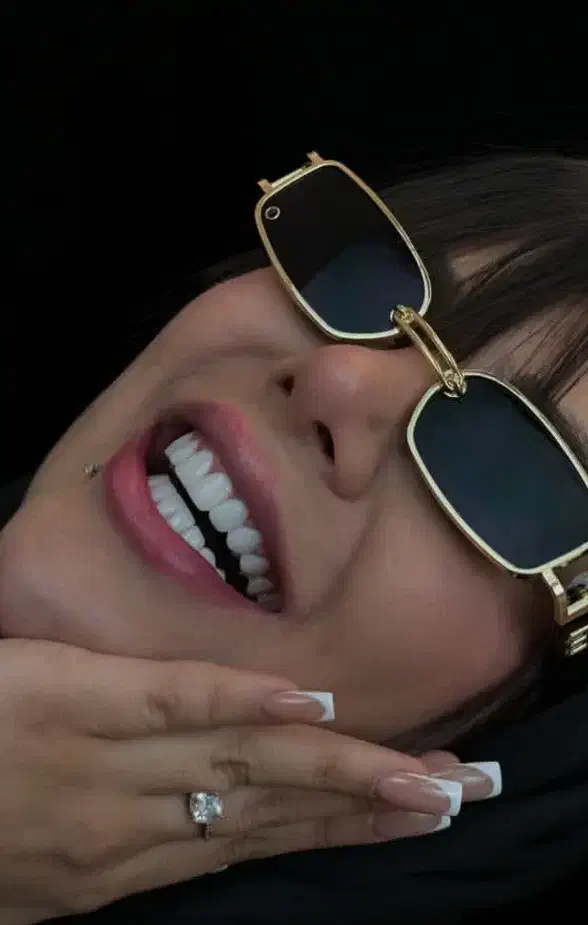 جشنواره کامپوزیت لمینت عصب imax روکش IPSونیر دندان|خدمات آرایشگری و زیبایی|تهران, فرمانیه|دیوار