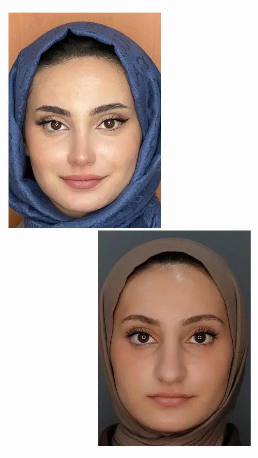 جشنواره عمل بینی (تخفیف ویژە )|خدمات آرایشگری و زیبایی|کاشان, شهدا|دیوار