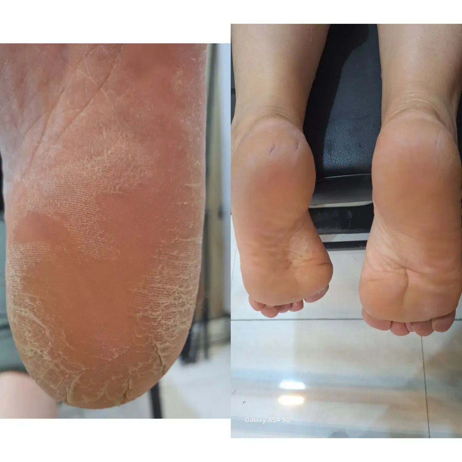 پدیکور. پا|خدمات آرایشگری و زیبایی|یاسوج, |دیوار