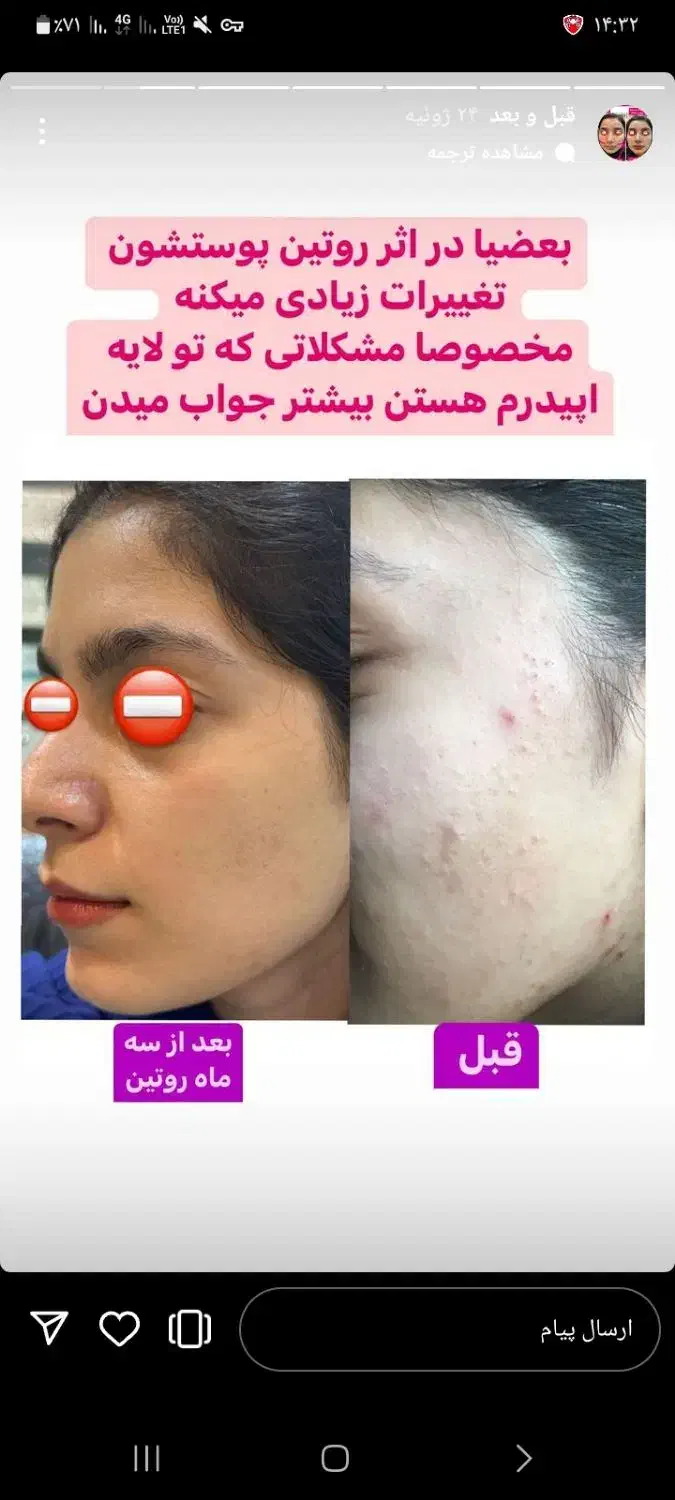 رایگان نیست دادن روتین پوست فقط آنلاین|آرایشی، بهداشتی، درمانی|اصفهان, عاشق‌آباد|دیوار