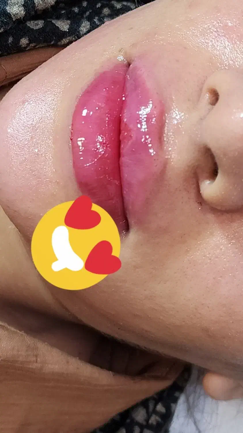ژل وبوتاکس|خدمات آرایشگری و زیبایی|اهواز, ۲۴ متری|دیوار