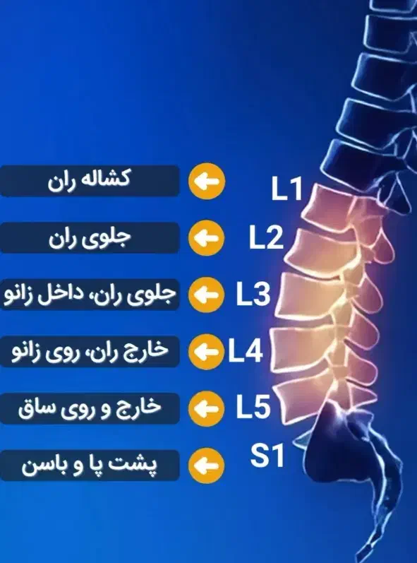 التیام درد دیسک و سیاتیک|آرایشی، بهداشتی، درمانی|قم, عمار یاسر|دیوار