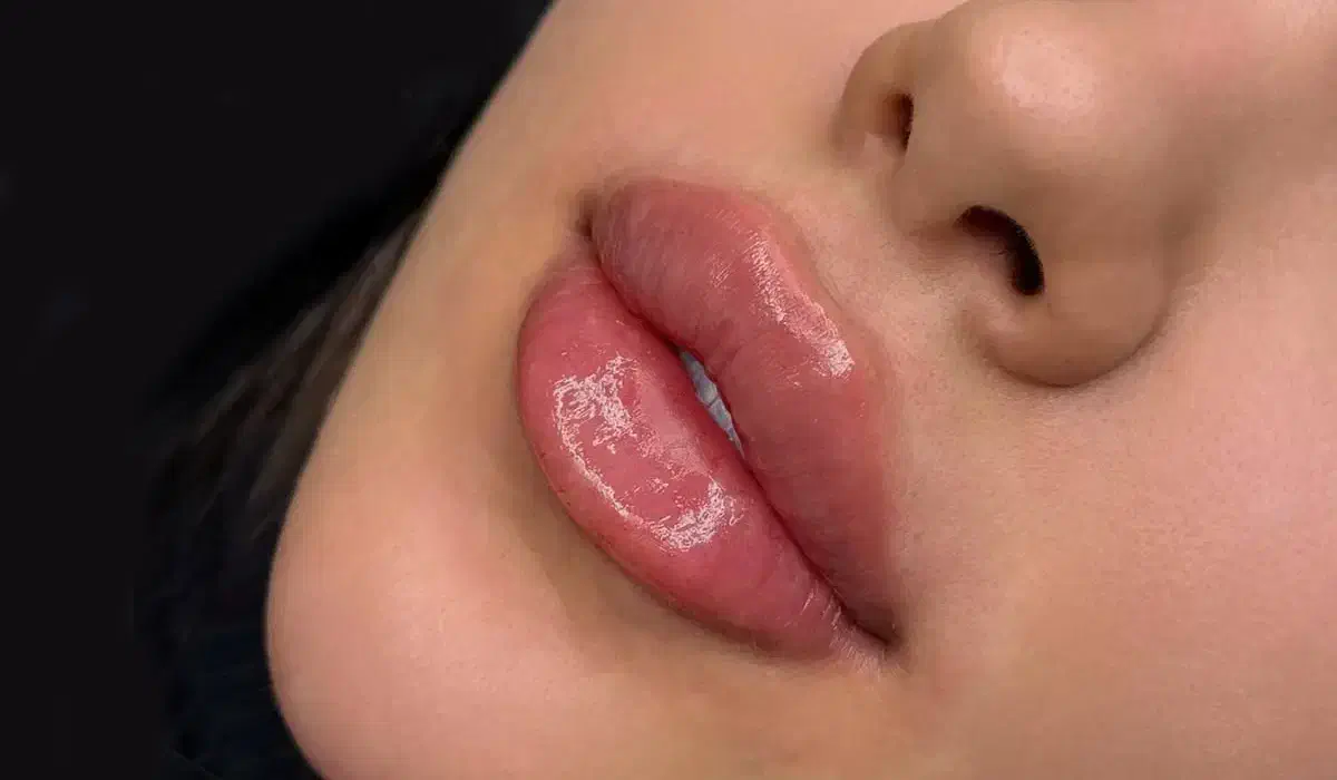 خدمات زیبای فیلر و بوتاکس|خدمات آرایشگری و زیبایی|اسلامشهر, شهرک مصطفی خمینی|دیوار