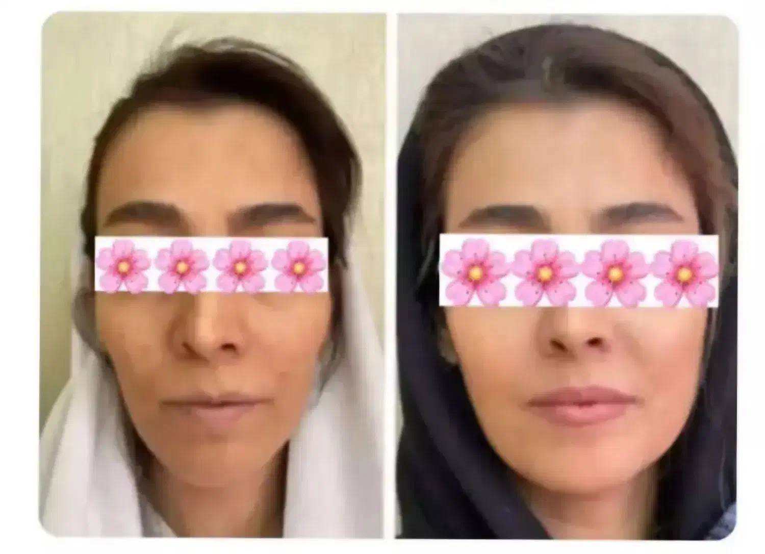 چاقی صورت و بدن تضمینی|خوردنی و آشامیدنی|طبس, |دیوار